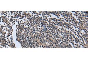 Immunohistochemistry of paraffin-embedded Human tonsil tissue using WNT9B Polyclonal Antibody at dilution of 1:85(x200) (WNT9B anticorps)