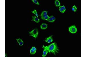 Immunofluorescent analysis of MCF-7 cells using ABIN7173115 at dilution of 1:100 and Alexa Fluor 488-congugated AffiniPure Goat Anti-Rabbit IgG(H+L)