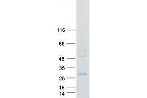 Validation with Western Blot