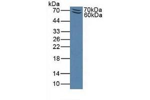 Detection of Recombinant PSGL1, Mouse using Polyclonal Antibody to P-Selectin Glycoprotein Ligand 1 (PSGL1)