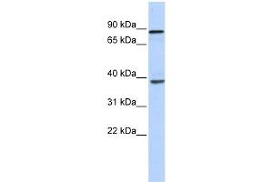 WB Suggested Anti-DHX35 Antibody Titration:  0.