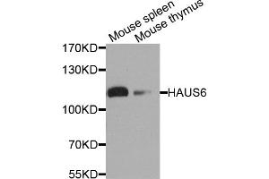 Western blot analysis of extracts of various cell lines, using HAUS6 antibody. (FAM29A anticorps)