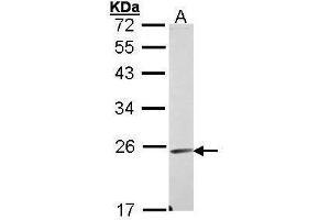 WB Image Sample (30 ug of whole cell lysate) A: A431 , 12% SDS PAGE antibody diluted at 1:1000 (Endomucin anticorps)