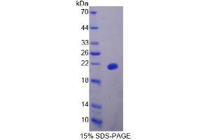 SDS-PAGE analysis of Mouse UXT Protein.