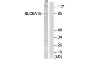 Western blot analysis of extracts from Jurkat cells, using SLC6A15 Antibody. (SLC6A15 anticorps  (AA 32-81))