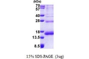 SDS-PAGE (SDS) image for Ribosomal Protein S19 (RPS19) (AA 1-145) protein (His tag) (ABIN6387234) (RPS19 Protein (AA 1-145) (His tag))