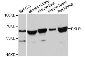 Western blot analysis of extracts of various cell lines, using PKLR antibody (ABIN5998530) at 1:3000 dilution. (PKLR anticorps)