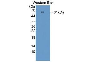 Detection of Recombinant PRCP, Mouse using Polyclonal Antibody to Prolylcarboxypeptidase (PRCP) (PRCP anticorps  (AA 169-443))