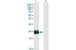 Western Blot analysis of IFT20 expression in transfected 293T cell line by IFT20 monoclonal antibody (M02), clone 3F3.