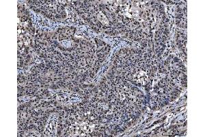 IHC analysis of SAP18 using anti-SAP18 antibody (ABIN7599009). (SAP18 anticorps  (AA 1-153))