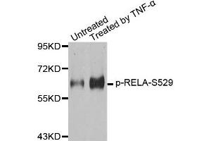 Western Blotting (WB) image for anti-Nuclear Factor-kB p65 (NFkBP65) (pSer529) antibody (ABIN1870581) (NF-kB p65 anticorps  (pSer529))