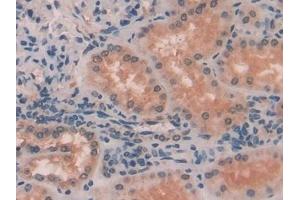 Detection of MYLK in Human Kidney Tissue using Polyclonal Antibody to Myosin Light Chain Kinase (MYLK) (MYLK anticorps  (AA 1661-1877))