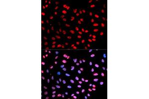 Immunofluorescent staining of U-2 OS cells with ESPL1 (phospho S1126) polyclonal antibody  at 1:20-1:100 dilution. (Separase anticorps  (pSer1126))
