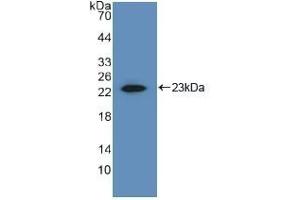 Detection of Recombinant MMP1, Human using Polyclonal Antibody to Matrix Metalloproteinase 1 (MMP1) (MMP1 anticorps  (AA 98-275))