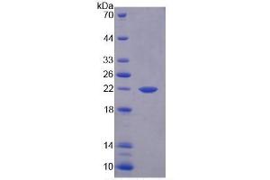 SDS-PAGE of Protein Standard from the Kit  (Highly purified E.