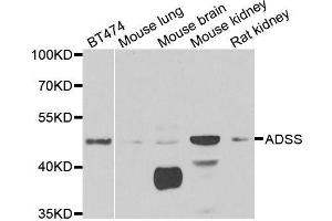 Western blot analysis of extracts of various cell lines, using ADSS antibody. (ADSS anticorps  (AA 1-280))
