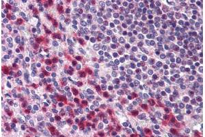 Human Spleen (formalin-fixed, paraffin-embedded) stained with BCLAF1 antibody ABIN296759 at 10 ug/ml followed by biotinylated goat anti-rabbit IgG secondary antibody ABIN481713, alkaline phosphatase-streptavidin and chromogen. (BCLAF1 anticorps  (AA 700-750))