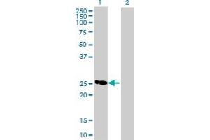 anti-Chromosome 19 Open Reading Frame 43 (C19ORF43) (AA 1-176) antibody