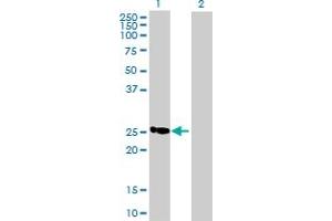 Western Blot analysis of C19orf43 expression in transfected 293T cell line by C19orf43 MaxPab polyclonal antibody. (C19orf43 anticorps  (AA 1-176))