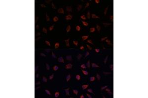 Immunofluorescence analysis of L929 cells using F antibody (ABIN6131636, ABIN6140414, ABIN6140415 and ABIN6220935) at dilution of 1:100. (FABP1 anticorps  (AA 1-127))