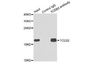 Immunoprecipitation analysis of 150ug extracts of MCF7 cells using 3ug TCEB2 antibody. (TCEB2 anticorps  (AA 1-118))
