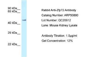 WB Suggested Anti-Zfp72 Antibody   Titration: 1. (Zfp72 anticorps  (N-Term))