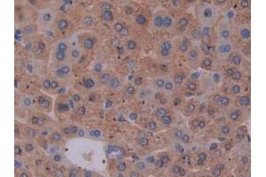 DAB staining on IHC-P; Samples: Mouse Liver Tissue