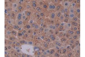 DAB staining on IHC-P; Samples: Mouse Liver Tissue (EBI3 anticorps  (AA 19-228))