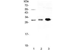 anti-VEGFB (VEGF2) antibody