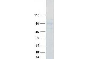 Validation with Western Blot