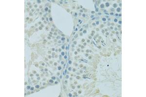 Immunohistochemistry of paraffin-embedded rat testis using PSIP1 antibody (ABIN6290727) at dilution of 1:100 (40x lens). (PSIP1 anticorps)