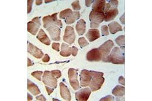 Immunohistochemistry analysis in formalin fixed and paraffin embedded skeletal muscle reacted with PATL1 Antibody (C-term) followed which was peroxidase conjugated to the secondary antibody and followed by DAB staining. (PATL1 anticorps  (C-Term))
