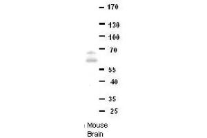DONSON antibody - middle region  validated by WB using Mouse brains at 1:1000.