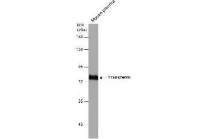 WB Image Mouse tissue extract (50 μg) was separated by 7. (Transferrin anticorps)