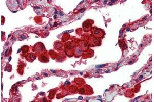 Human Lung: Formalin-Fixed, Paraffin-Embedded (FFPE) (Caspase 12 anticorps)