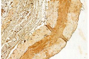 ABIN6262483 and ABIN6272845 at 1/100 staining Mouse skin tissue by IHC-P. (IFT88 anticorps  (C-Term))