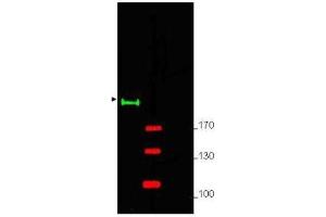 Western blot using  Affinity Purified anti-Gli-2 antibody shows detection of a predominant band at ~190 kDa corresponding to Gli-2 (arrowhead) in mouse brain whole cell lysate (lane 1). (GLI2 anticorps  (Internal Region))
