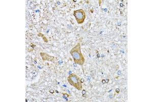 Immunohistochemistry of paraffin-embedded mouse spinal cord using HD antibody (ABIN6133742, ABIN6141675, ABIN6141678 and ABIN6213911) at dilution of 1:100 (40x lens).