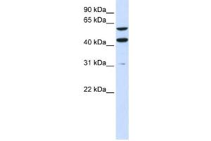 Western Blotting (WB) image for anti-phosphatidylserine Synthase 1 (PTDSS1) antibody (ABIN2459069) (PTDSS1 anticorps)