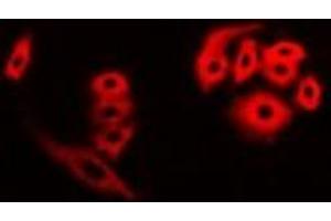 Immunofluorescent analysis of FHR3 staining in A549 cells. (CFHR3 anticorps)