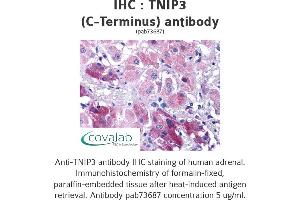 Image no. 1 for anti-TNFAIP3 Interacting Protein 3 (TNIP3) (C-Term) antibody (ABIN1740204) (TNIP3 anticorps  (C-Term))