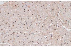 Immunohistochemistry of paraffin-embedded Rat heart using TLK1 Polyclonal Antibody at dilution of 1:100 (40x lens).