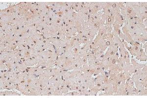 Immunohistochemistry of paraffin-embedded Rat heart using TLK1 Polyclonal Antibody at dilution of 1:100 (40x lens). (TLK1 anticorps)
