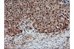 Immunohistochemistry (IHC) image for anti-Proteasome Subunit alpha 4 (PSMA4) antibody (ABIN1500458)