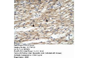 Rabbit Anti-PREB Antibody       Paraffin Embedded Tissue:  Human cardiac cell   Cellular Data:  Epithelial cells of renal tubule  Antibody Concentration:   4.