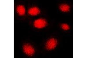 Immunofluorescent analysis of hNRNP C staining in MCF7 cells. (HNRNPC anticorps  (C-Term))