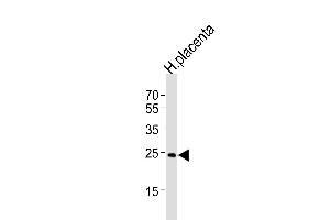 Western blot analysis of lysate from human placenta tissue lysate, using ANP32B Antibody (N-term) (ABIN1539101 and ABIN2848657).