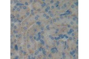 IHC-P analysis of Kidney tissue, with DAB staining. (COQ6 anticorps  (AA 1-476))