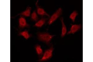 ABIN6275988 staining HepG2 by IF/ICC. (GPR37L1 anticorps  (N-Term))