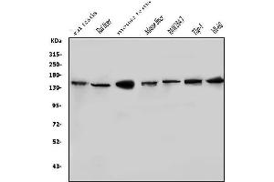 Western blot analysis of HDAC9 using anti-HDAC9 antibody (ABIN7602333).